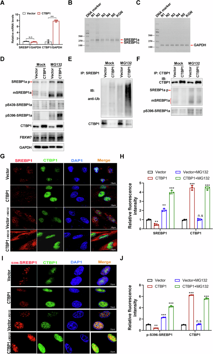 Fig. 6: CTBP1 mediates SREBP1 protein degradation.