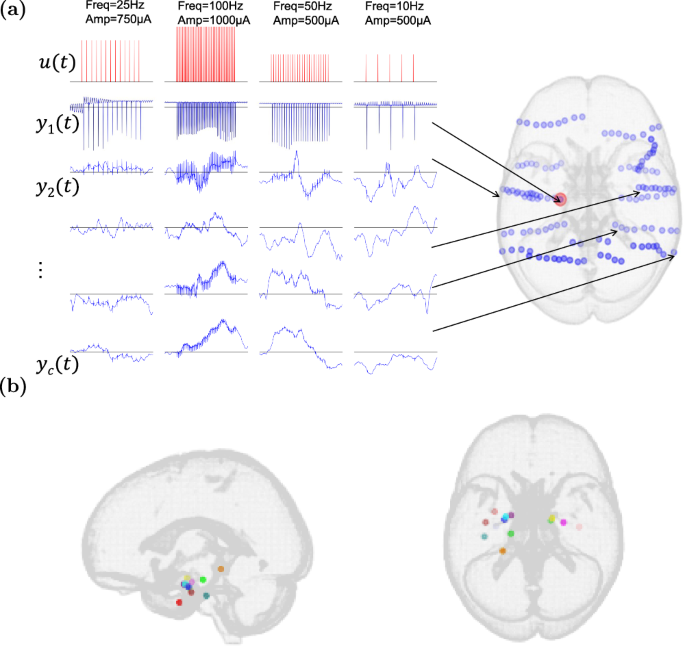 Fig. 1: Illustration of the iEEG data used in this work.