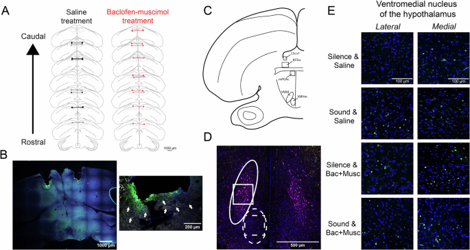 Fig. 2: Targeting of cannulas and regions of interest.