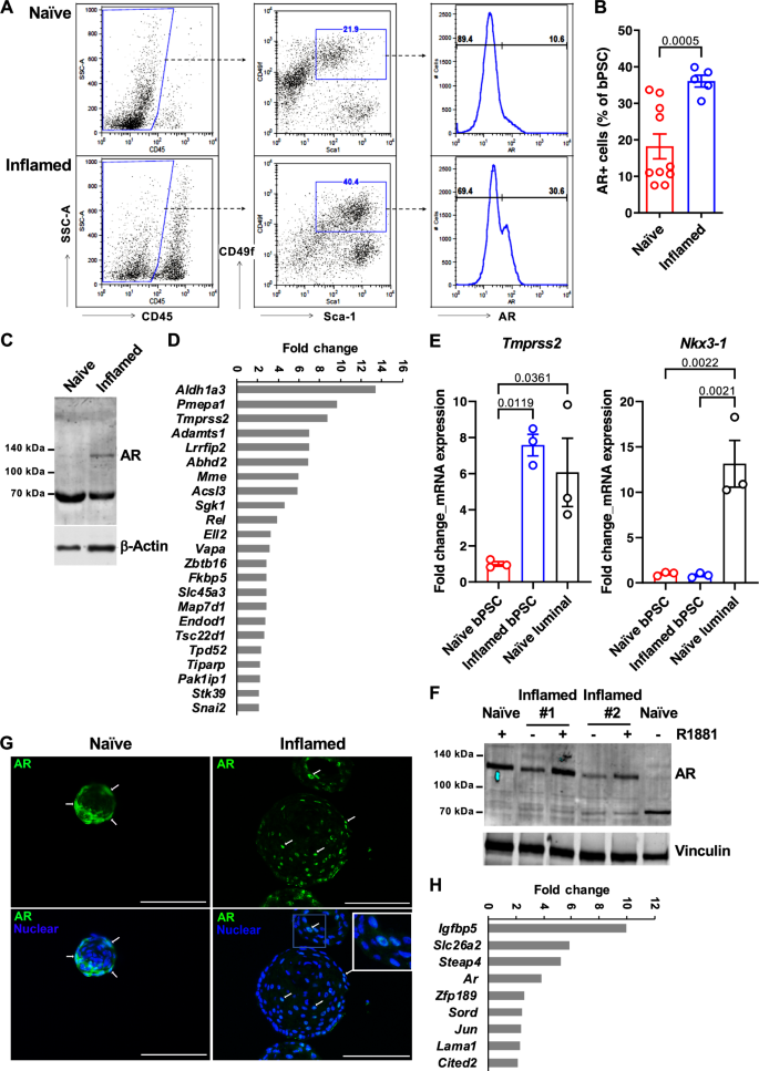 Fig. 1: AR expression and activity are elevated in bPSC freshly isolated from inflamed prostates and the enhanced AR activity is sustained in inflamed organoids in the absence of androgen.