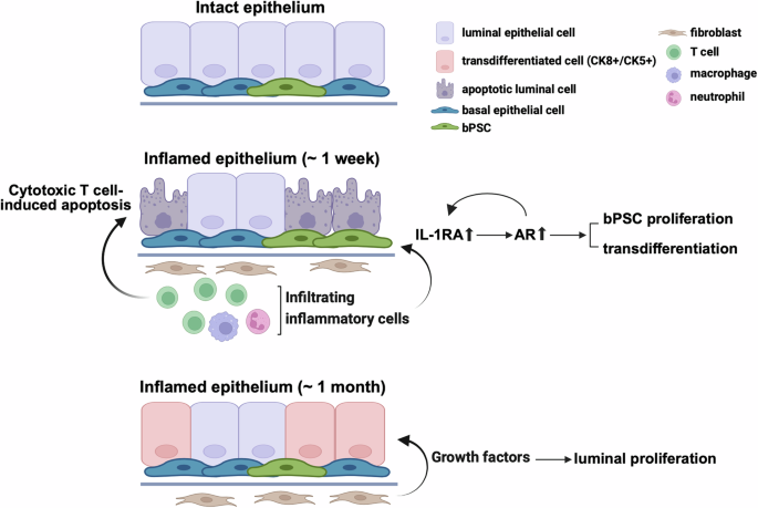 Fig. 7: Diagram of enhanced AR signaling, bPSC proliferation, and differentiation that are mediated through IL-1RA during prostate inflammation that mimics non-bacterial prostatitis.