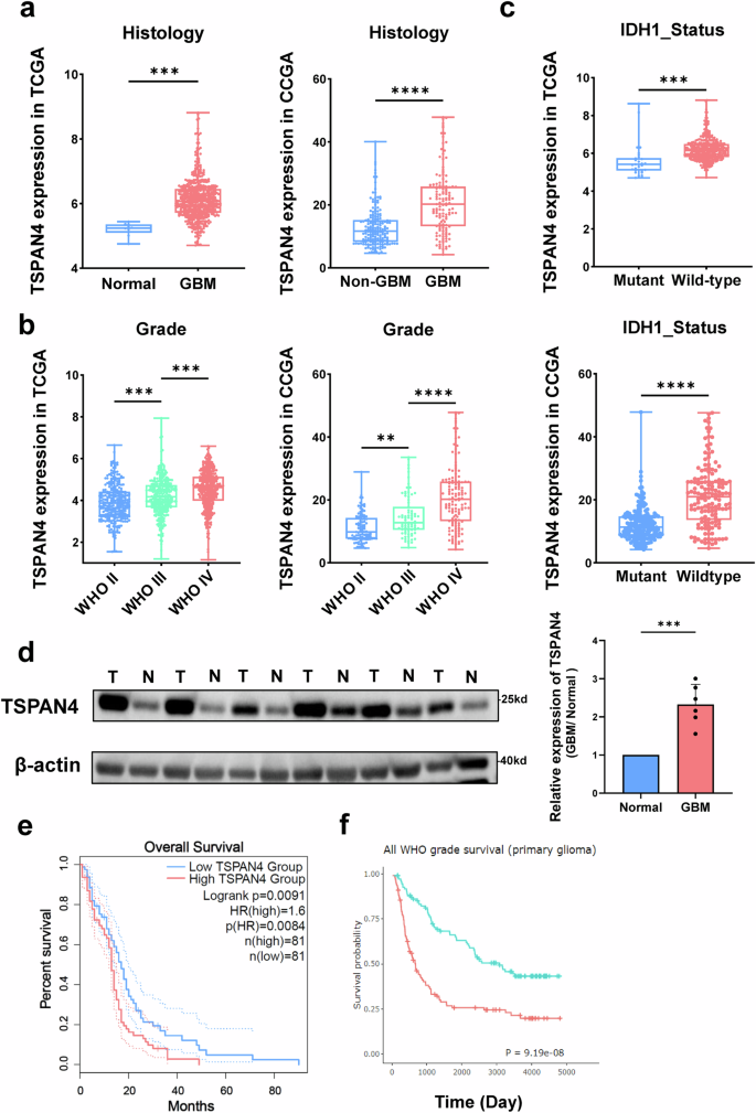 Fig. 2: Correlation of increased TSPAN4 expression with glioma malignancy and poor patient prognosis.