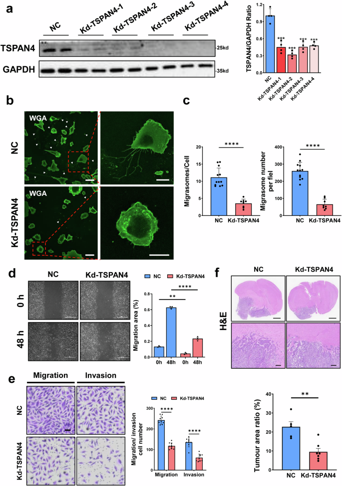 Fig. 3: TSPAN4 regulates the migration and invasion of GBM cells.