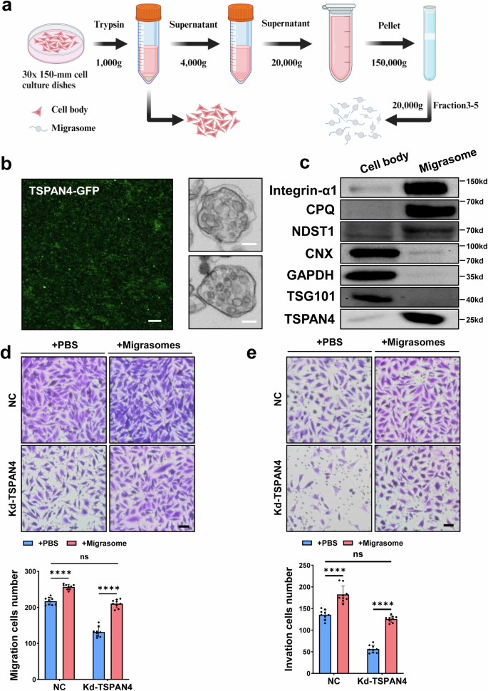 Fig. 4: Enhancement of GBM migration and invasion by Migrasomes.