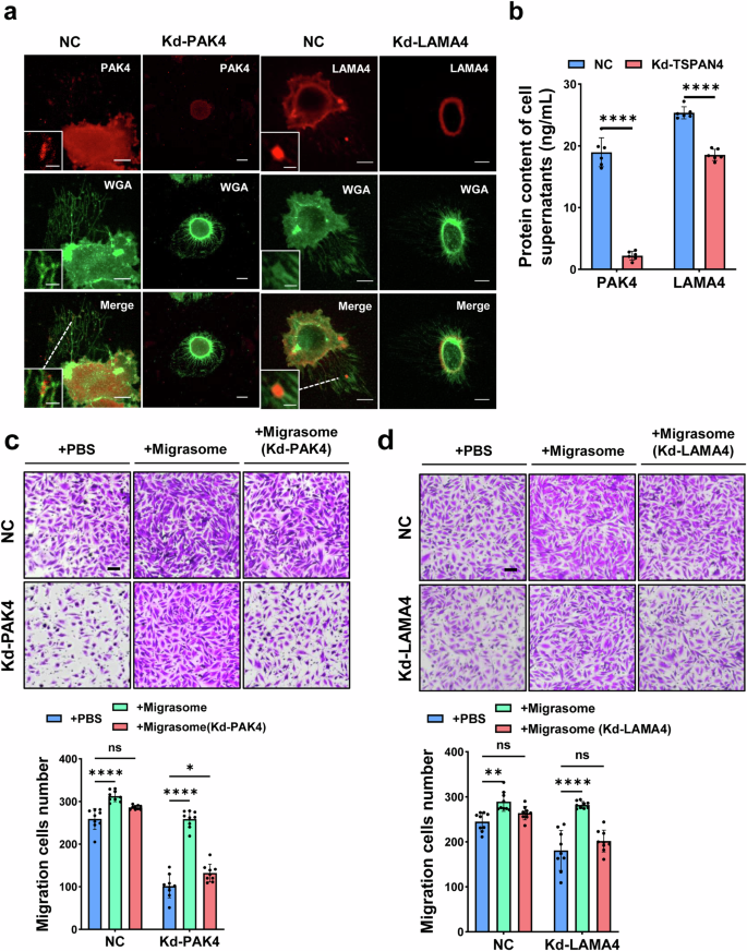 Fig. 6: Promotion of GBM migration by migrasomes via PAK4 and LAMA4.