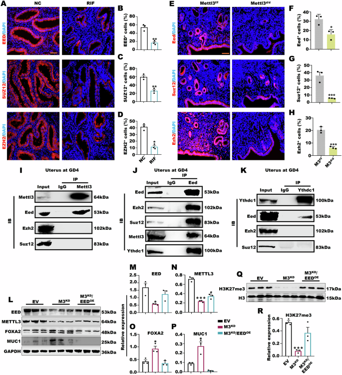Fig. 6: Mettl3d/d inhibited endometrial receptivity by affecting histone modification.
