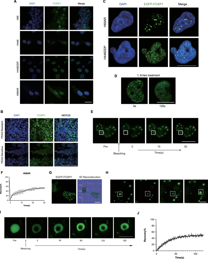 Fig. 4: FOXP1 undergoes LLPS in SCLC.