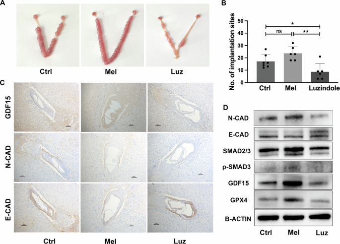 Fig. 8: The mouse in vivo embryo implantation model was used to explore the involvement of GDF15 pathway in the regulation of embryo implantation by melatonin.