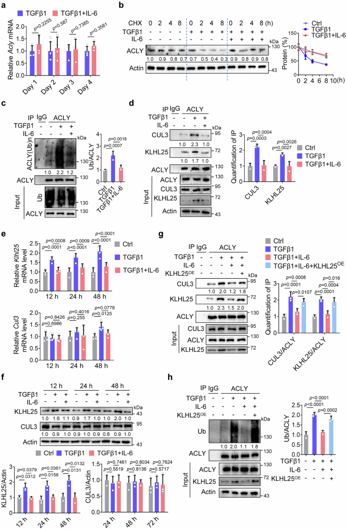 Fig. 2: IL-6 inhibits TGFβ1-induced-Klhl25 transcription to repress ACLY ubiquitination.