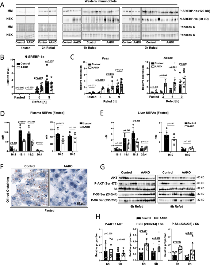 Fig. 1: Adipose tissue ATGL regulates SREBP-1c in the liver.