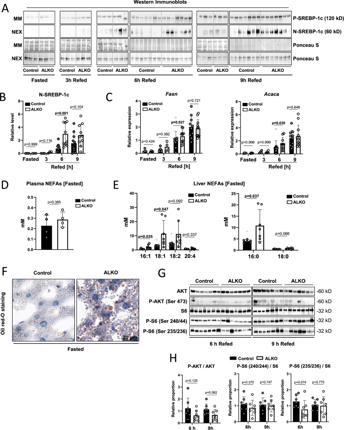 Fig. 2: SREBP-1c processing in mice lacking ATGL in the liver.