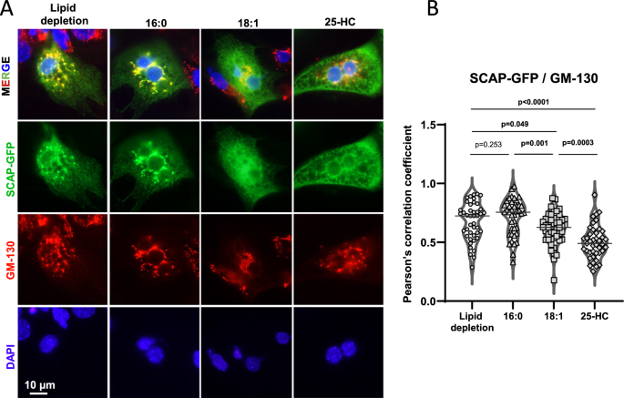 Fig. 6: SREBP-1c cleavage-activation is suppressed by lipolysis derived uFAs.