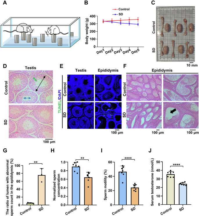 Fig. 2: Sleep deprivation (SD) leads to male reproductive system dysfunction.