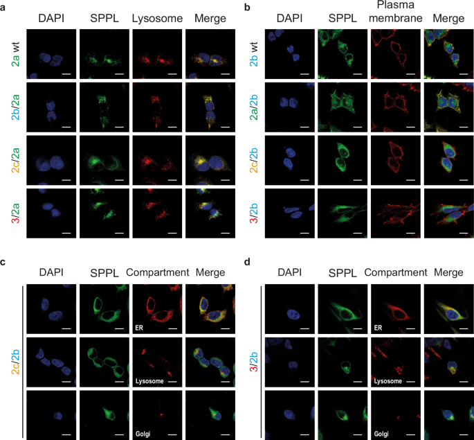 Fig. 3: Subcellular localization of chimeric proteases.