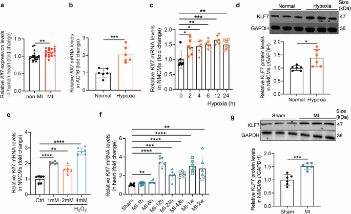 Fig. 1: Upregulation of KLF7 expression in hypoxic cardiomyocytes and ischemic heart.