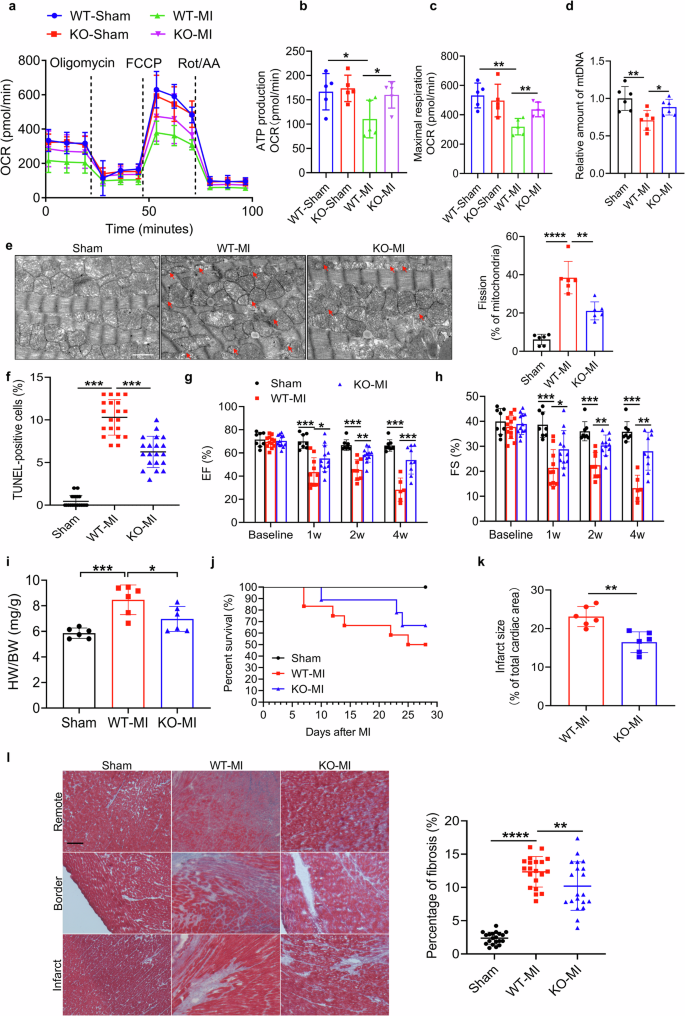 Fig. 2: Cardiomyocyte-specific Klf7 deletion alleviates cardiac and mitochondrial dysfunction after myocardial infarction.