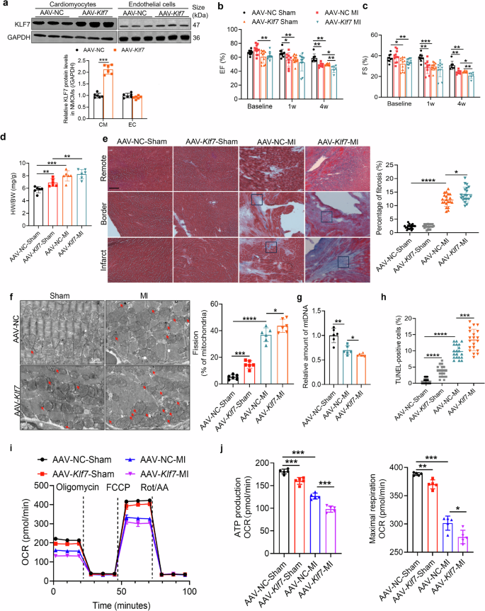 Fig. 4: Cardiomyocyte-specific overexpression of Klf7 aggravates cardiac and mitochondrial dysfunction induced by myocardial infarction.