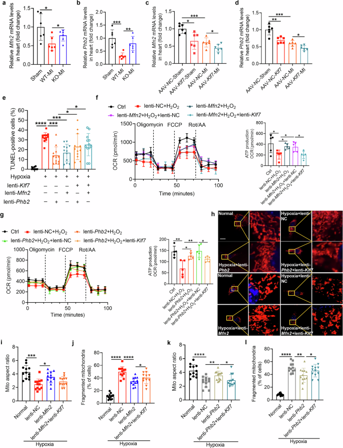 Fig. 7: Klf7 regulates mitochondrial fission and fusion by targeting Mfn2 and Phb2.