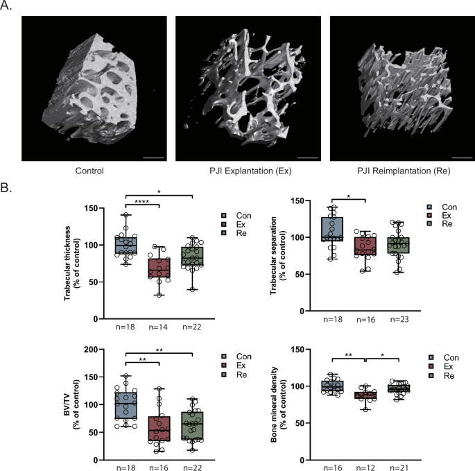 Fig. 1: µCT scans of intra-operatively obtained femoral bone specimens.