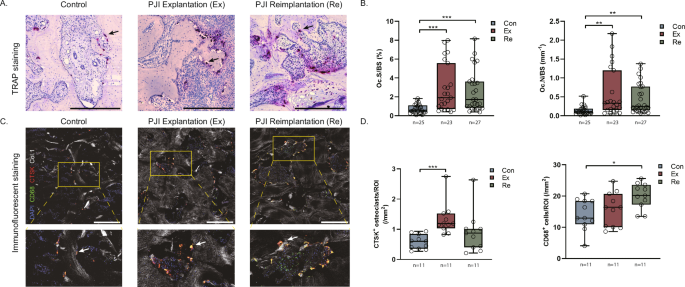 Fig. 2: PJI-induced local osteoclastogenesis.