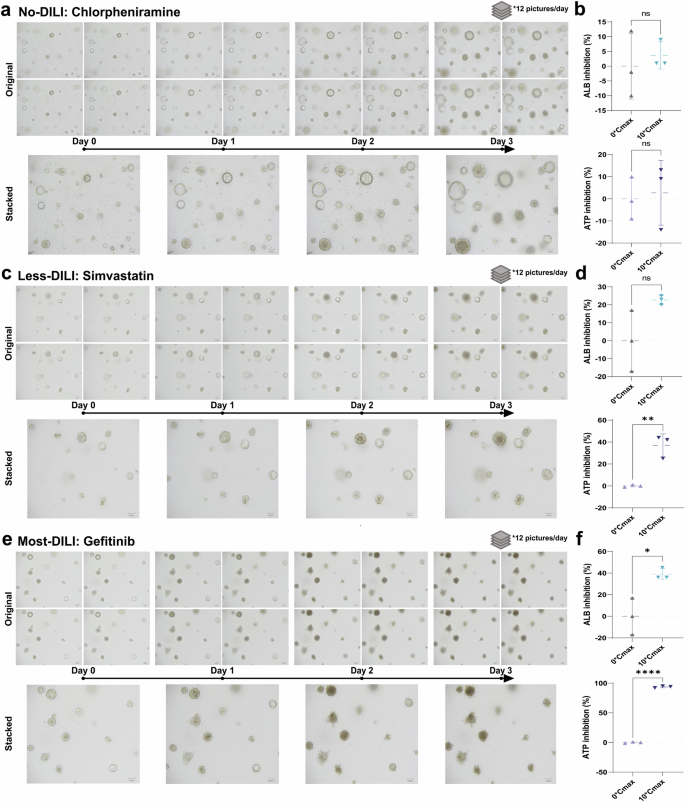 Fig. 2: DILI toxicity testing platform based on human liver organoid models.