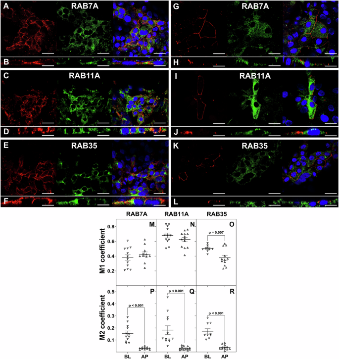 Fig. 7: Distribution of RAB7A, RAB11A, and RAB35 GTPases along the basolateral and apical membranes of polarized Huh7-A-I cells.