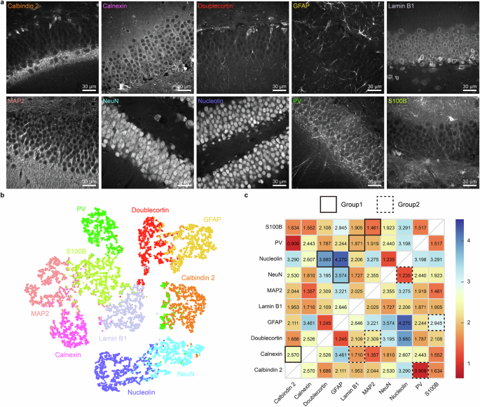 Fig. 2: Feature vector extraction and feature-based distance.