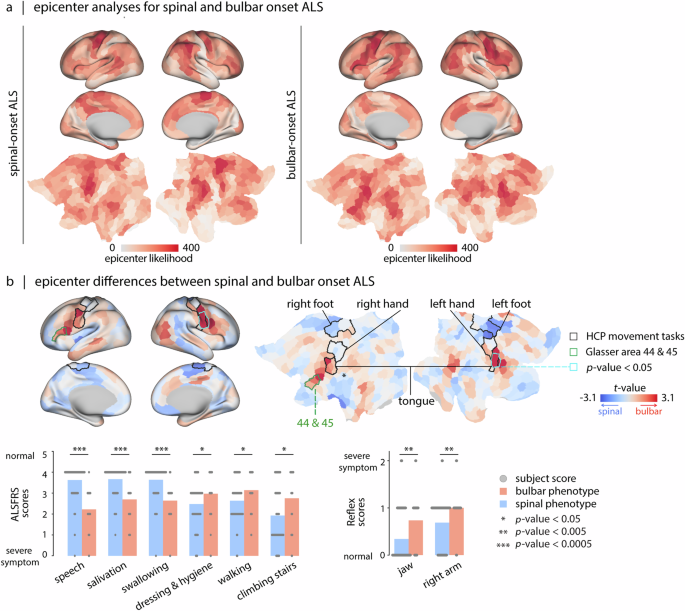 Fig. 6: Atrophy epicenters in spinal- and bulbar-onset ALS.