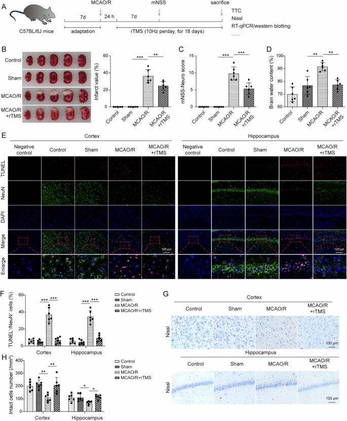Fig. 1: rTMS ameliorated brain injury in MCAO/R mice.