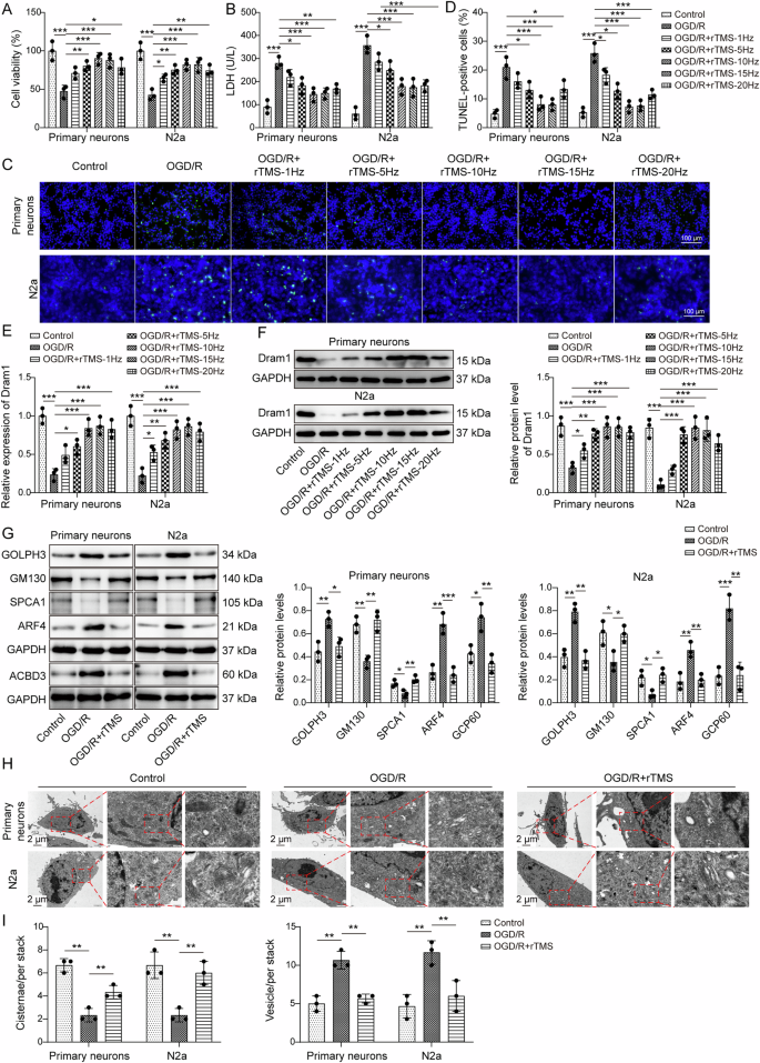 Fig. 2: rTMS suppressed OGD/R-induced GA stress and neuronal damage by upregulating Dram1.