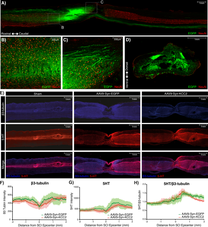 Fig. 5: Immunohistochemical analysis of the impact of AAV9-mediated gene therapy across the spinal cord (n = 4 per group).