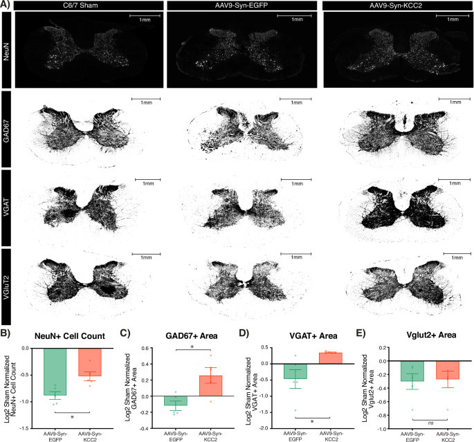 Fig. 6: KCC2 upregulation enhances neuronal preservation in the lesional and perilesional cervical spinal cord (n = 5 per group).