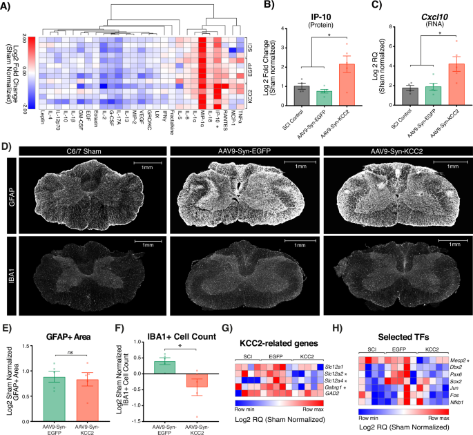 Fig. 7: KCC2 upregulation alters the neuroglial response in the injured spinal cord.