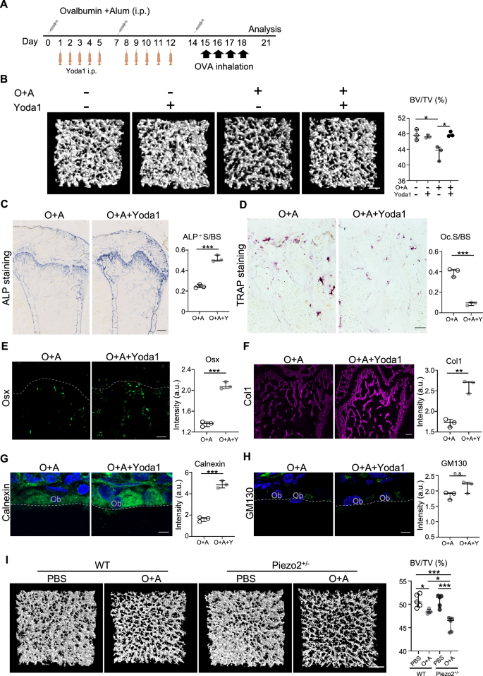 Fig. 5: Piezo modulation influences OVA-induced bone loss.
