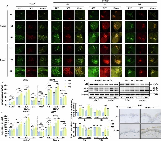 Fig. 2: BCL11A deficiency enhances UVB-induced autophagic flux.