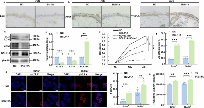 Fig. 5: BCL11A overexpression exacerbated UVB-induced cell damage by inhibiting autophagy.
