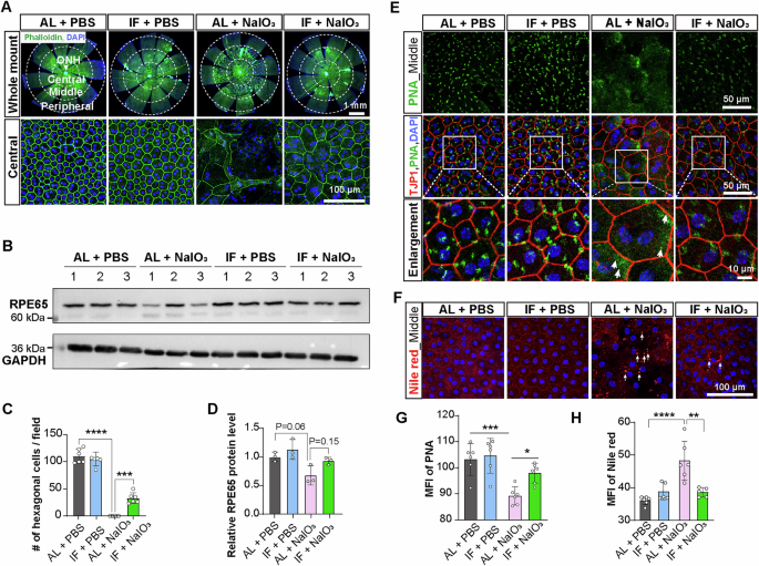 Fig. 2: IF protects the RPE from structural and functional disorders induced by NaIO3.
