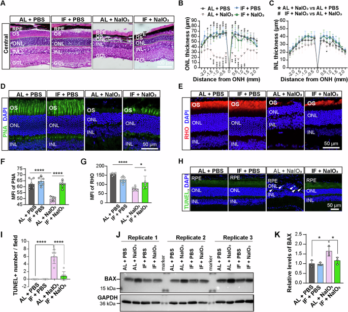 Fig. 3: IF rescues NaIO3-induced photoreceptor degeneration.