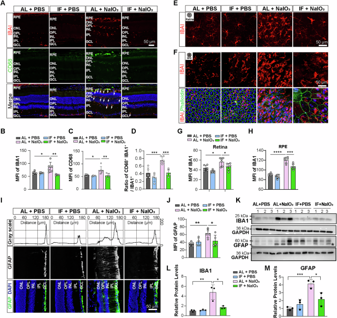 Fig. 6: IF treatment suppresses NaIO3-inuced glial hyperactivation.