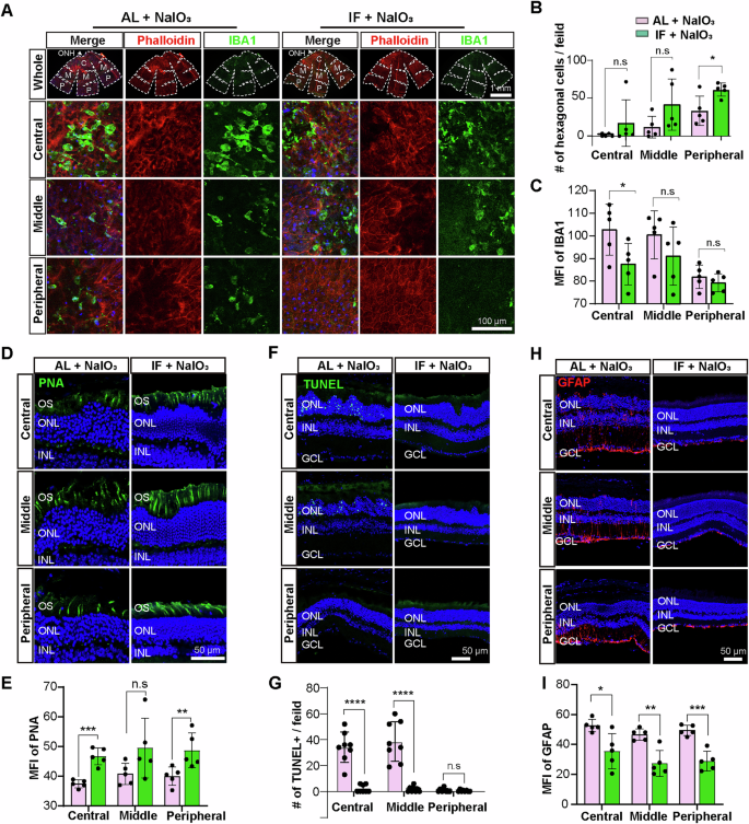 Fig. 7: IF exerts retinoprotective effects in older mice.
