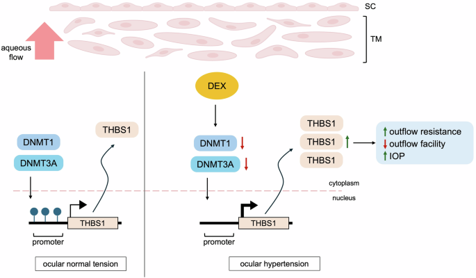 Fig. 7: Proposed mechanism of DEX-induced ocular hypertension and POAG.