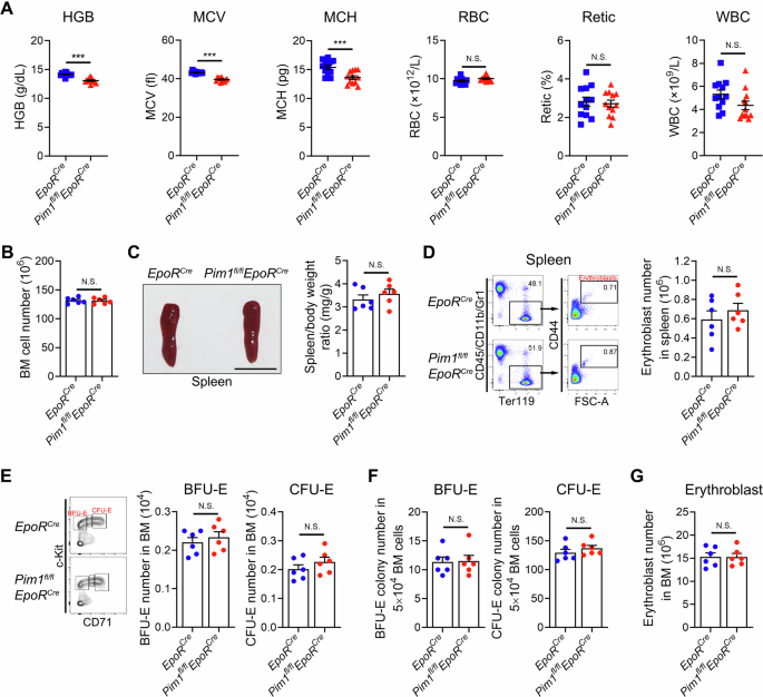 Fig. 3: Pim1fl/flEpoRCre mice exhibited microcytic and hypochromic red blood cells.