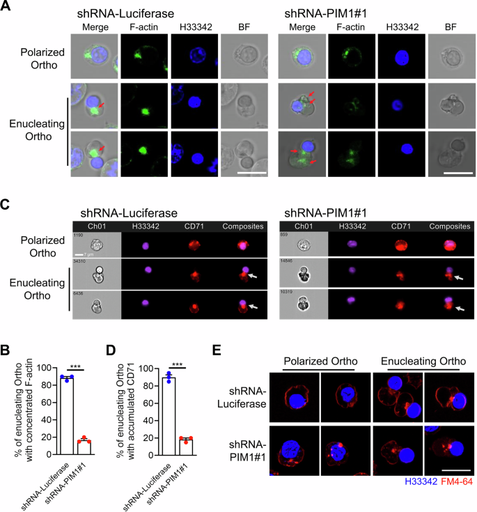 Fig. 7: PIM1 controlled F-actin network and vesicle trafficking in Ortho.