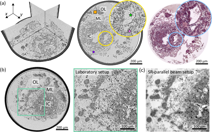 Fig. 4: 3D virtual histology of HFOs based on laboratory μ-CT.