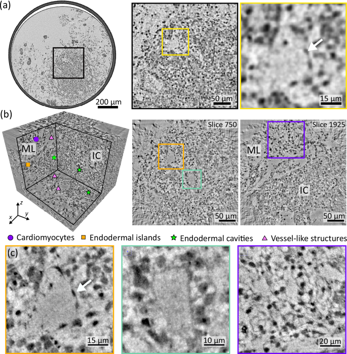Fig. 5: High-resolution XPCT of an HFO.