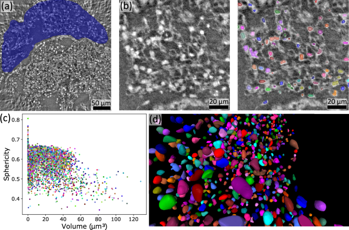 Fig. 6: Segmentation of the cardiomyocytes cell nuclei in the myocardial layer using the high-resolution tomographic dataset.