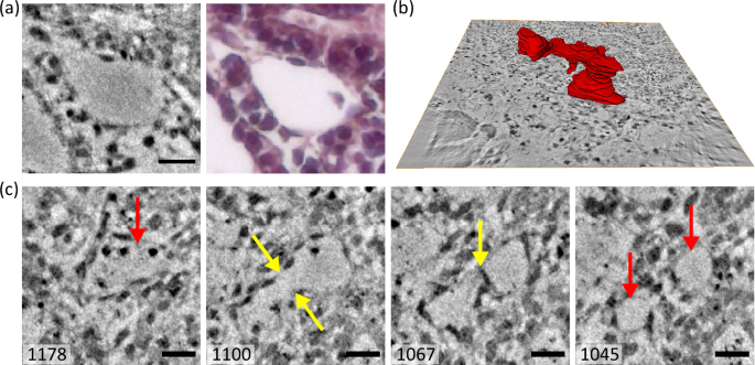 Fig. 7: Branching of vessel-like structures and segmentation.