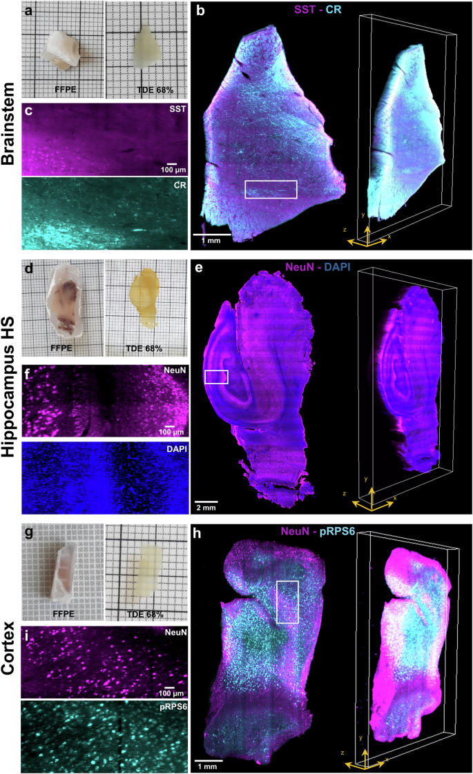 Fig. 2: LSFM 3D reconstructions with deparaffinized human brain slabs processed with the SHORT method.