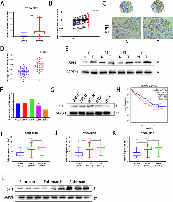 Fig. 1: SPI1 expression is upregulated in ccRCC and correlates with poor prognosis.