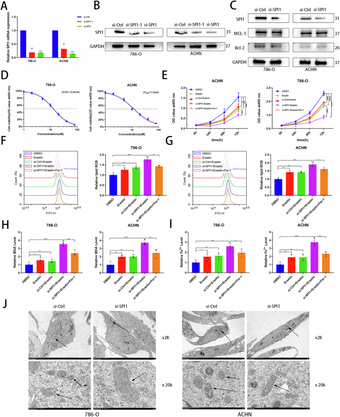 Fig. 2: Knockdown of SPI1 promotes ferroptosis in ccRCC.